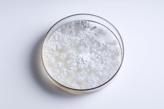 Bacterial colonies on agar agar in petri dish on white background photo
