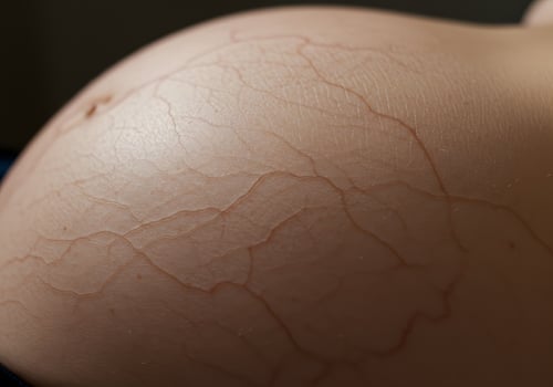 Pregnant belly skin texture photo