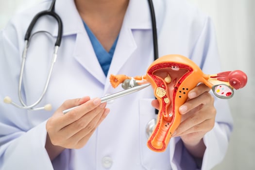 Uterus, doctor holding human anatomy model for diagnosis photo