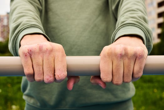 A Firm Grip on a Fitness Bar in a Vibrant Urban Scene, Engaging in Active Training photo