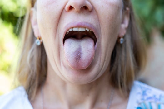 Open female mouth with blue tongue inside. Tongue coloring. photo