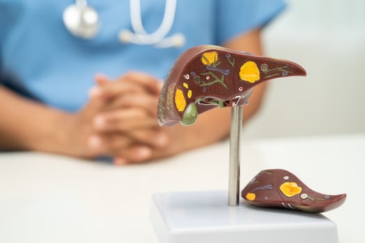 Cirrhosis, Liver cancer, fatty liver, Asian doctor with liver human anatomy model in World Hepatitis photo