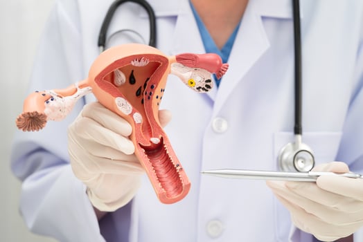 Uterus, doctor holding human anatomy model for study diagnosis photo