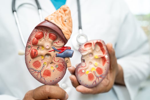 Kidney disease Chronic ckd photo