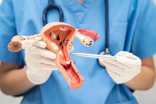 Uterus, doctor holding human anatomy model study diagnosis photo