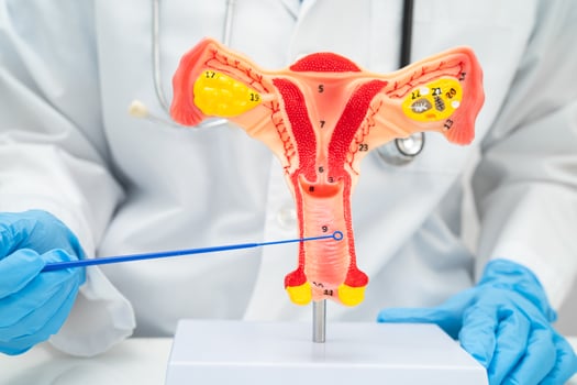 Doctor holding human uterus model for vaginal and cervix pap smear check up in the obstetrics photo