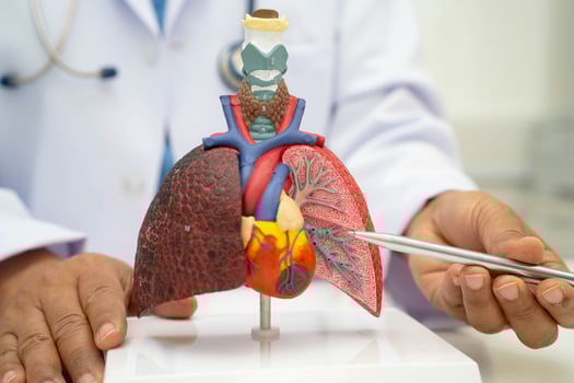 Pneumonia, lung cancer, Asian doctor holding human anatomy model for diagnosis photo