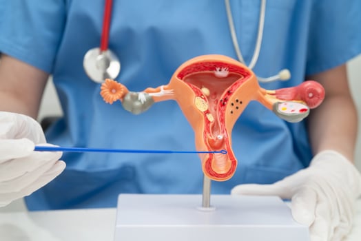 Doctor holding human uterus model for vaginal and cervix pap smear check up in obstetrics photo