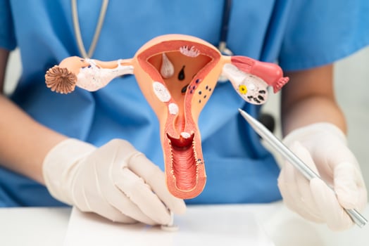 Uterus, doctor holding human anatomy model for study diagnosis and photo