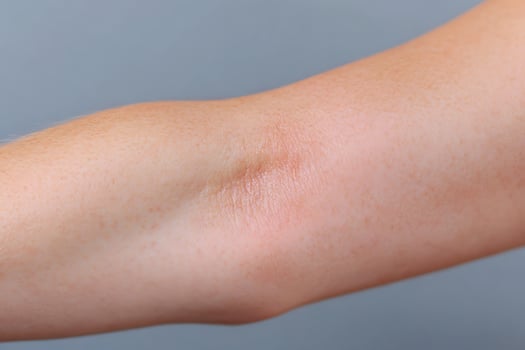 Detailed view of human skin texture and imperfections. photo