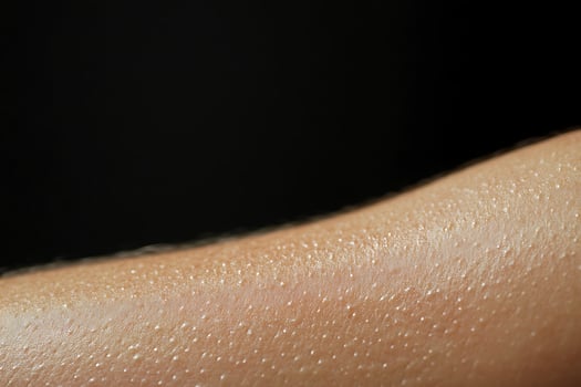 Close up of human skin covered in small water droplets. photo