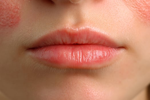 Close up of a person's healthy glowing lips with a hint of blush. photo