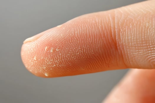 Macro view of a fingertip showing skin texture and fine dust particles. photo