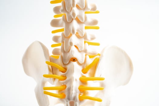 Lumbar spine displaced herniated disc fragment, spinal nerve and bone. photo