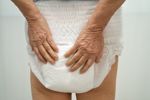 Asian senior woman patient wearing diaper. photo