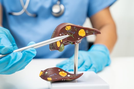 Cirrhosis, Liver cancer, fatty liver, Asian doctor with liver human anatomy model in World photo