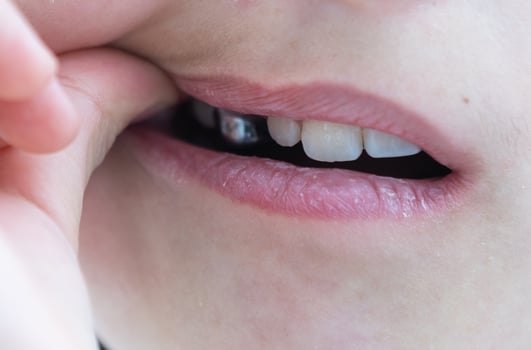Portrait of little cute girl shows her orthodontic appliance on a white background photo