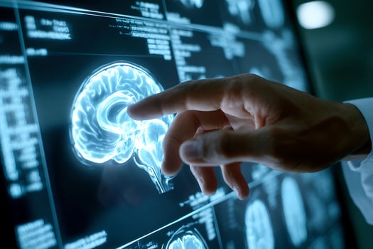 A person pointing at a screen with a brain image photo