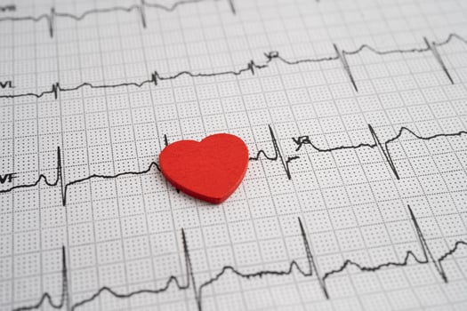 Electrocardiogram ECG heart wave photo
