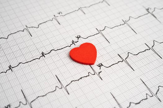Electrocardiogram ECG, heart wave photo