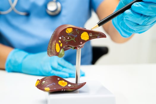 Cirrhosis, Liver cancer, fatty liver, Asian doctor with liver human anatomy model World Hepatitis Day photo