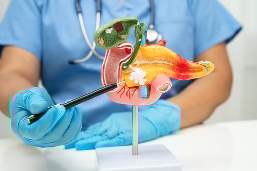 Pancreatitis, pancreatic cancer, Asian doctor with pancreas, gallbladder and bile duct human anatomy at hospital. photo