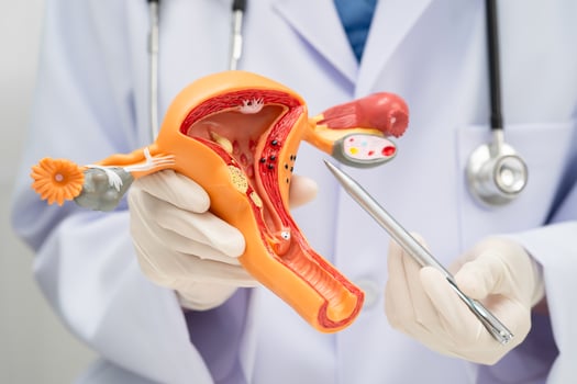 Uterus, doctor holding human anatomy model photo