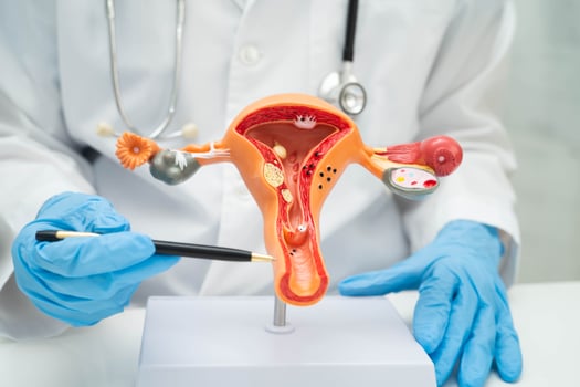doctor with Uterus photo