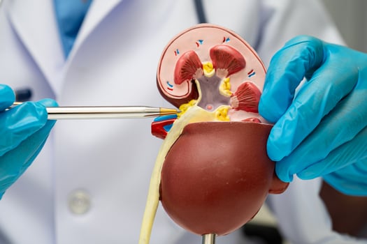 Chronic kidney disease, doctor with model for treatment urinary urology photo