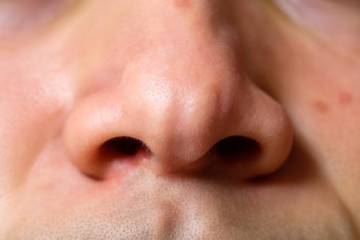 Close-up of a human nose, featuring smooth skin and subtle texture details. photo