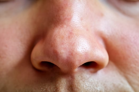 Close-up of a human nose highlighting skin texture and features, emphasizing details and imperfections. photo