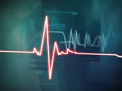 Illustration of a digital heartbeat monitor displaying an ECG waveform in blue and red tones. photo