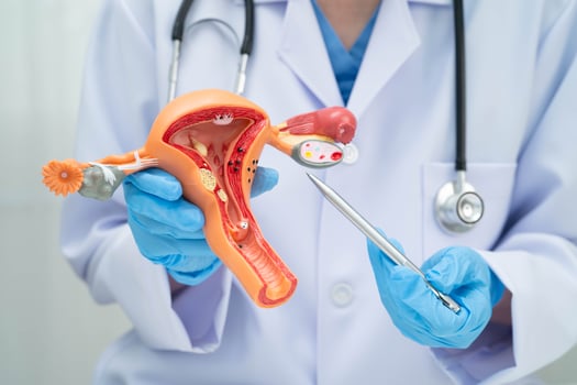 Uterus, doctor holding human anatomy model for study diagnosis and treatment photo