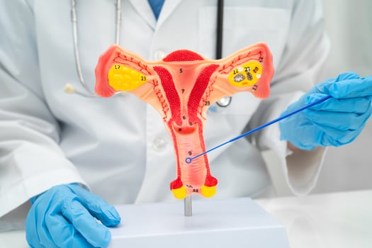 Doctor holding uterus model for vaginal and cervix pap smear check up in obstetrics photo