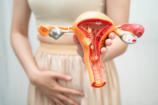 Uterus, woman holding photo