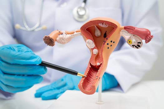 Uterus, doctor holding human anatomy for diagnosis photo