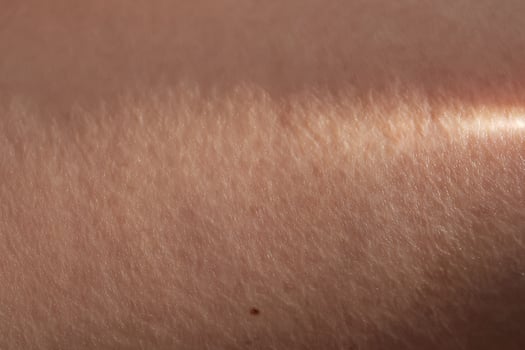 The texture of the skin with a ray of sunshine on it. photo