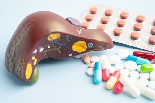 Liver model with pill drug treatment, Cirrhosis Liver cancer photo