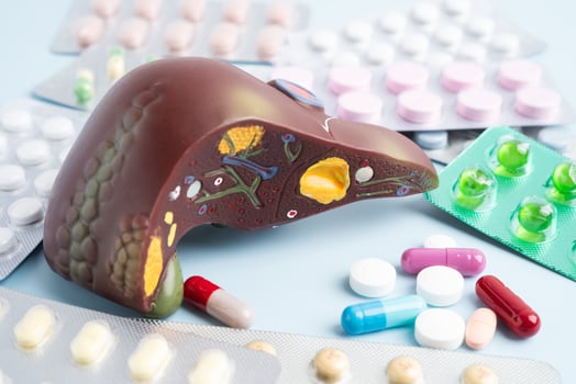 Liver model with pill drug treatment, Cirrhosis, Liver cancer photo