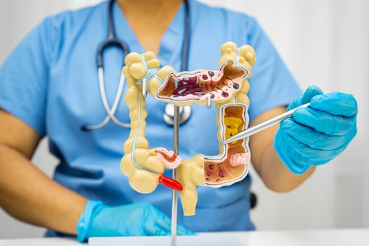 Intestine, Asian woman holding human anatomy photo