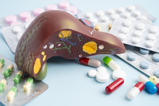 Liver model with pill drug treatment, Liver cancer photo