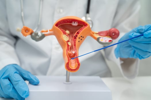 Doctor holding human uterus model for vaginal and cervix pap smear check up in the obstetrics gynecology. photo