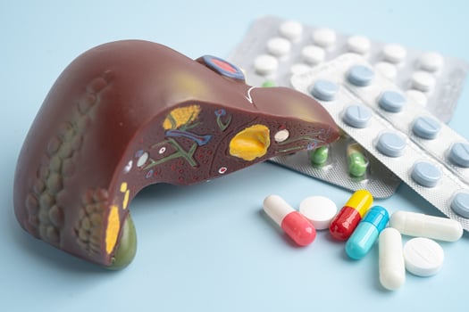 Liver model with pill drug Cirrhosis, photo