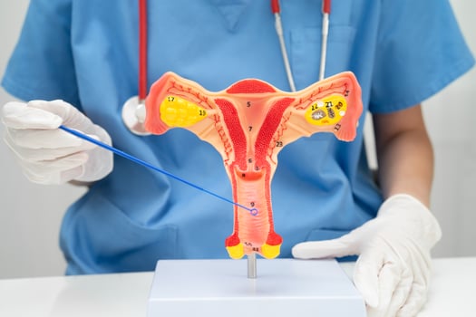 Doctor holding human uterus model for vaginal and cervix pap smear check up photo