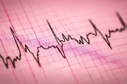 Medical heartbeat monitor displaying vital signs on an electrocardiogram sheet photo