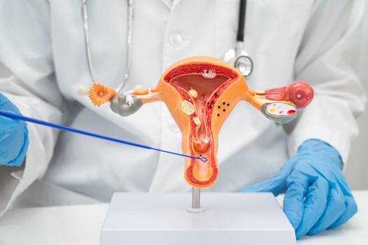 Doctor holding human uterus model for vaginal and cervix pap smear check up in the obstetrics photo