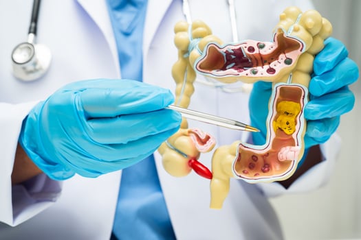 Intestine, doctor holding human anatomy model for study diagnosis in hospital. photo