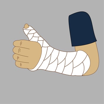 hand in a cast or bandage. vector illustration