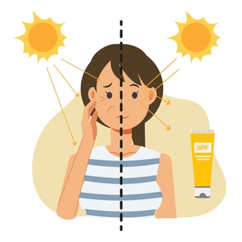 Skin care concept,sun protection.skin damage UV.Vector cartoon of comparison about using and not use sunblock product. vector