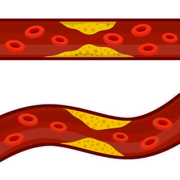 Blood cholesterol. Veins and arteries with fat. Problem with vascular system. vector